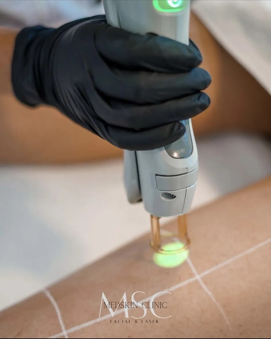 laser clinic amsterdam